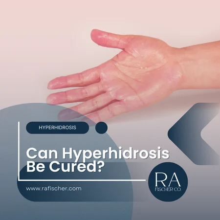 Blog image cover for blog post "Can Hyperhidrosis Be Cured?" Can hyperhidrosis be cured? While there’s no permanent solution, treatments like iontophoresis with The Fischer offer safe and effective ways to manage excessive sweating.