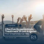 Effective Hyperhidrosis Treatment in Los Angeles: How Iontophoresis Can Help