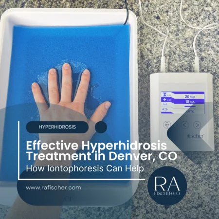 Hyperhidrosis Treatment in Denver, Colorado. Image of The Fischer iontophoresis treatment for effective hyperhidrosis in Denver, Colorado USA. Blog post cover image #2