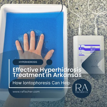 Hyperhidrosis Treatment in Arkansas. Image of The Fischer iontophoresis treatment for effective hyperhidrosis in Arkansas USA. Blog post cover image #2