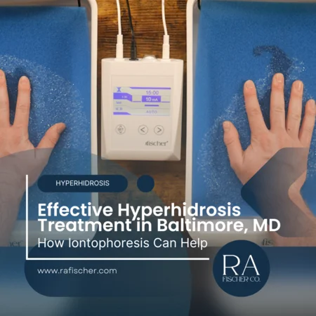 Hyperhidrosis Treatment in Baltimore, Maryland. Image of The Fischer iontophoresis treatment for effective hyperhidrosis in Baltimore, Maryland USA. Blog post cover image #2