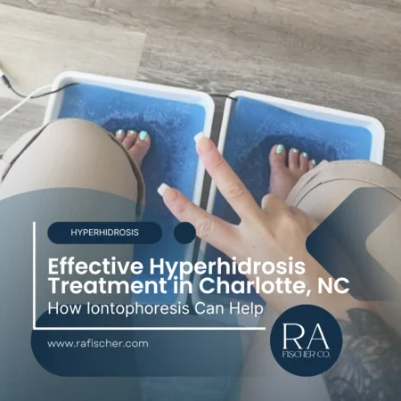 Hyperhidrosis Treatment in Charlotte, North Carolina. Image of The Fischer iontophoresis treatment for effective hyperhidrosis in Charlotte, North Carolina USA. Blog post cover image #2