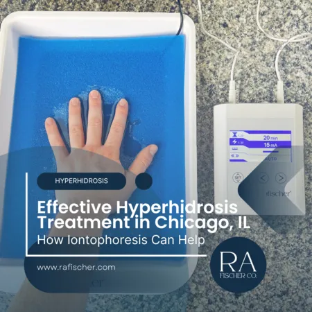 Hyperhidrosis Treatment in Chicago, Illinois. Image of The Fischer iontophoresis treatment for effective hyperhidrosis in Chicago, Illinois USA. Blog post cover image #2