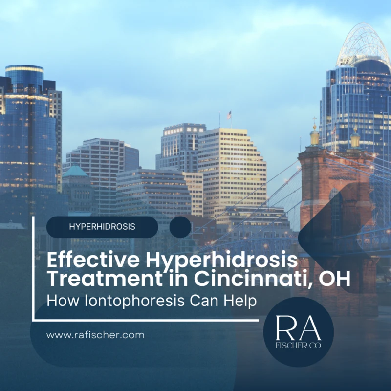 Hyperhidrosis Treatment in Cincinnati, Ohio. Image of The Fischer iontophoresis treatment for effective hyperhidrosis in Cincinnati, Ohio USA. Blog post cover image #1