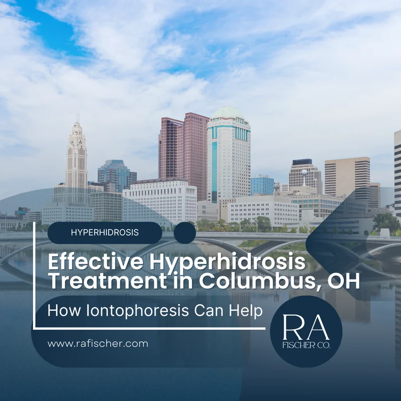 Hyperhidrosis Treatment in Columbus, Ohio. Image of The Fischer iontophoresis treatment for effective hyperhidrosis in Columbus, Ohio USA. Blog post cover image #1