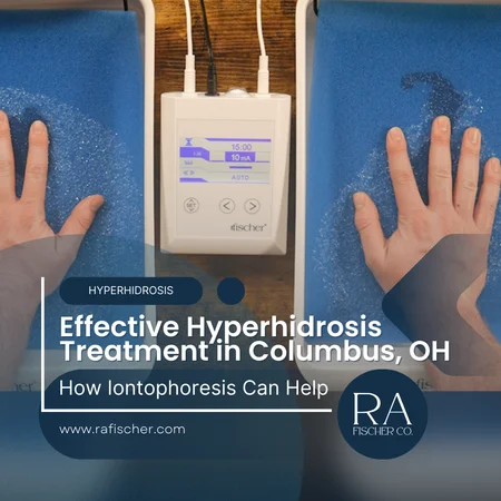 Hyperhidrosis Treatment in Columbuas, Ohio. Image of The Fischer iontophoresis treatment for effective hyperhidrosis in Columbus, Ohio USA. Blog post cover image #2