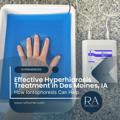 Hyperhidrosis Treatment in Des Moines, Iowa. Image of The Fischer iontophoresis treatment for effective hyperhidrosis in Des Moines, Iowa USA. Blog post cover image #2