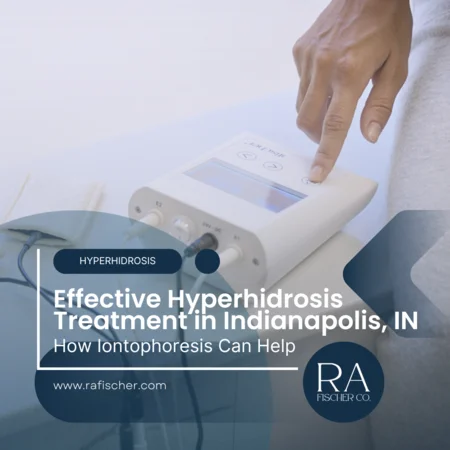 Hyperhidrosis Treatment in Indianapolis, Indiana. Image of The Fischer iontophoresis treatment for effective hyperhidrosis in Indianapolis, Indiana USA. Blog post cover image #2