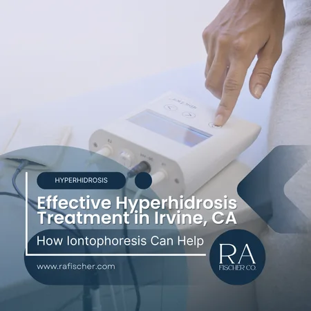 Hyperhidrosis Treatment in Irvine, California. Image of The Fischer iontophoresis treatment for effective hyperhidrosis in Irvine, California USA. Blog post cover image #2