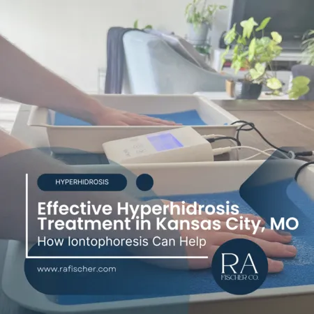 Hyperhidrosis Treatment in Kansas City, Missouri. Image of The Fischer iontophoresis treatment for effective hyperhidrosis in Kansas City, Missouri USA. Blog post cover image #2