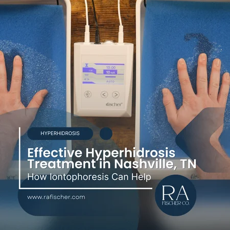 Hyperhidrosis Treatment in Nashville, Tennessee. Image of The Fischer iontophoresis treatment for effective hyperhidrosis in Nashville, Tennessee USA. Blog post cover image #2