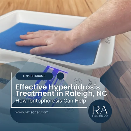 Hyperhidrosis Treatment in Raleigh, North Carolina. Image of The Fischer iontophoresis treatment for effective hyperhidrosis in Raleigh, North Carolina USA. Blog post cover image #2