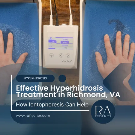 Hyperhidrosis Treatment in Richmond, VA. Image of The Fischer iontophoresis treatment for effective hyperhidrosis in Richmond, VA USA. Blog post cover image #2