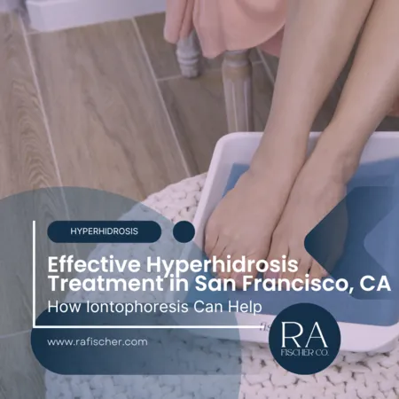 Hyperhidrosis Treatment in San Francisco, California. Image of The Fischer iontophoresis treatment for effective hyperhidrosis in San Francisco, California USA. Blog post cover image #2