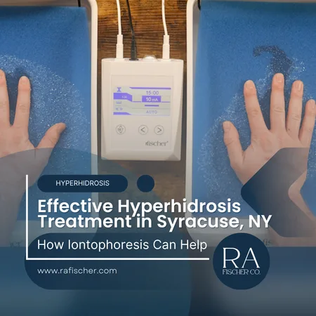 Hyperhidrosis Treatment in Syracuse, NY. Image of The Fischer iontophoresis treatment for effective hyperhidrosis in Syracuse, NY USA. Blog post cover image #2